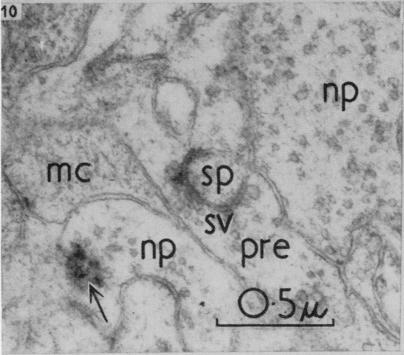 https://cdn.ncbi.nlm.nih.gov/pmc/blobs/410a/1244141/3ae2e3fca10a/janat00431-0066-d.jpg