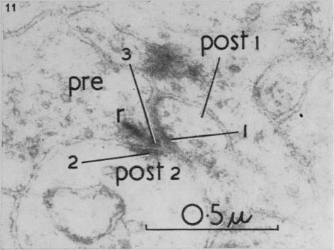https://cdn.ncbi.nlm.nih.gov/pmc/blobs/410a/1244141/9e64117c7df6/janat00431-0066-e.jpg
