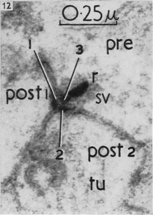 https://cdn.ncbi.nlm.nih.gov/pmc/blobs/410a/1244141/cea2c9871577/janat00431-0066-f.jpg