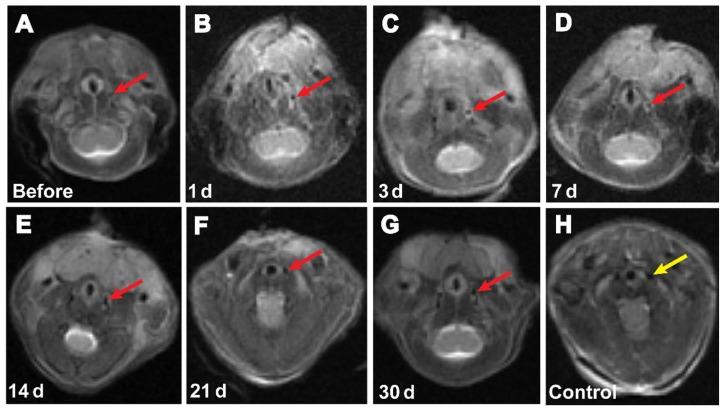 https://cdn.ncbi.nlm.nih.gov/pmc/blobs/410a/3487538/bb31ce414ed2/ijn-7-5191f6.jpg