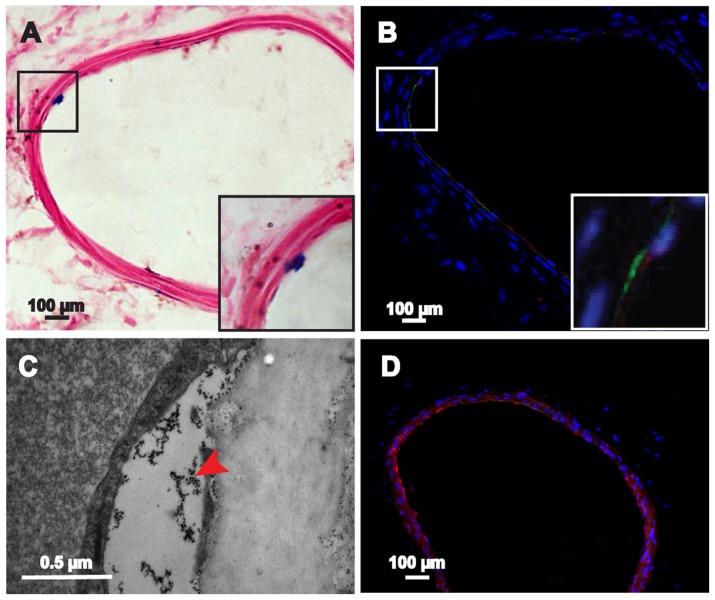 https://cdn.ncbi.nlm.nih.gov/pmc/blobs/410a/3487538/f7809972d87b/ijn-7-5191f8.jpg