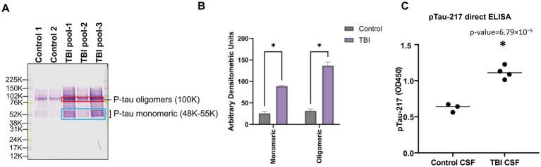 https://cdn.ncbi.nlm.nih.gov/pmc/blobs/410b/12344560/b9b52323b20c/fneur-16-1632679-g003.jpg