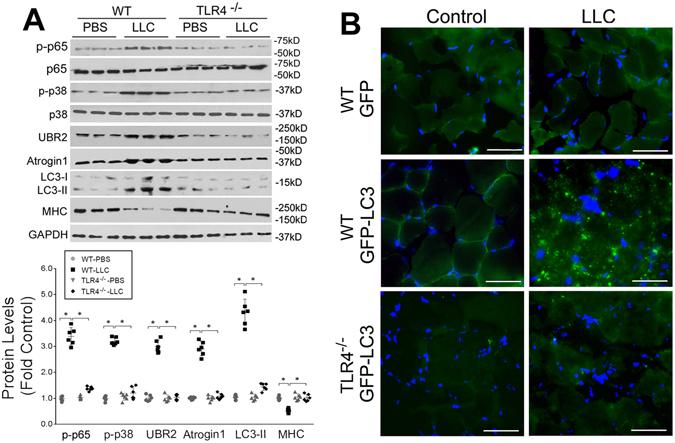 https://cdn.ncbi.nlm.nih.gov/pmc/blobs/4116/5442131/1988502477ab/41598_2017_2347_Fig4_HTML.jpg