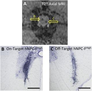 https://cdn.ncbi.nlm.nih.gov/pmc/blobs/4123/5442757/ad137f387b0c/SCT3-6-139-g004.jpg