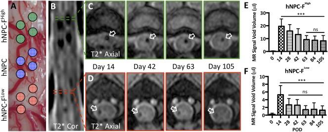 https://cdn.ncbi.nlm.nih.gov/pmc/blobs/4123/5442757/d13032f46edb/SCT3-6-139-g003.jpg