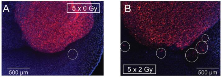 https://cdn.ncbi.nlm.nih.gov/pmc/blobs/4124/11640451/1562d7617280/cancers-16-03900-g002.jpg