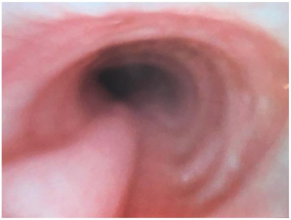 https://cdn.ncbi.nlm.nih.gov/pmc/blobs/4124/7745610/06853eda62ce/10.1177_1089253220919289-fig4.jpg