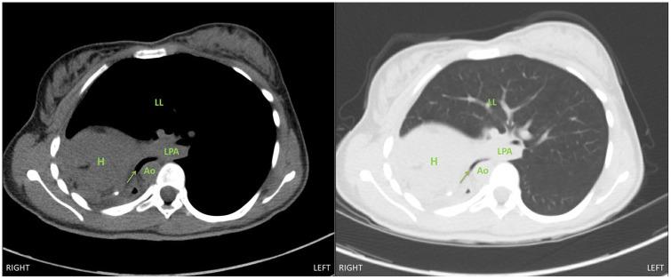 https://cdn.ncbi.nlm.nih.gov/pmc/blobs/4124/7745610/7ac5bd957243/10.1177_1089253220919289-fig1.jpg