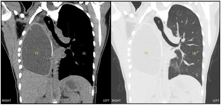 https://cdn.ncbi.nlm.nih.gov/pmc/blobs/4124/7745610/dad5f3961012/10.1177_1089253220919289-fig6.jpg