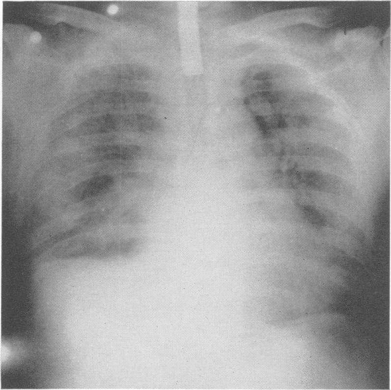 https://cdn.ncbi.nlm.nih.gov/pmc/blobs/4125/1387197/2d88b1dd670f/annsurg00427-0137-a.jpg