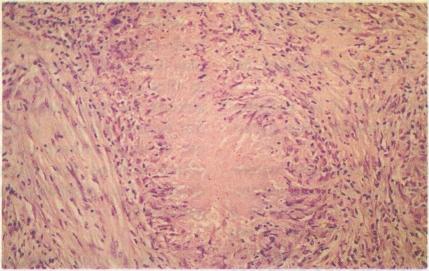 https://cdn.ncbi.nlm.nih.gov/pmc/blobs/4126/2548915/0996e6d0d0d3/bmj00581-0047-a.jpg