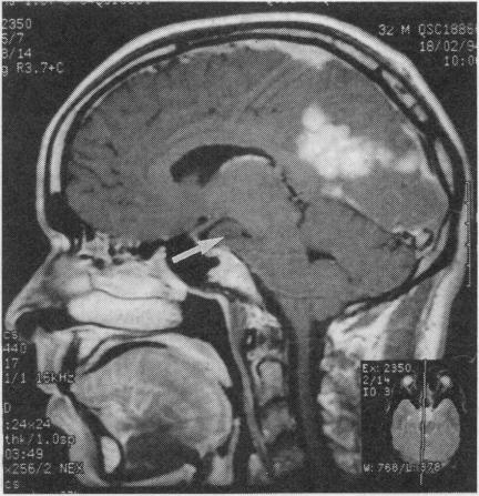 https://cdn.ncbi.nlm.nih.gov/pmc/blobs/4126/2548915/3c8b490fb215/bmj00581-0046-c.jpg