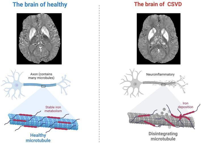 https://cdn.ncbi.nlm.nih.gov/pmc/blobs/4142/11275956/77ee25b6918a/fneur-15-1398009-g002.jpg