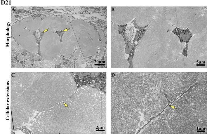 https://cdn.ncbi.nlm.nih.gov/pmc/blobs/4144/10494512/bf2a50b886b3/JBM4-7-e10792-g003.jpg