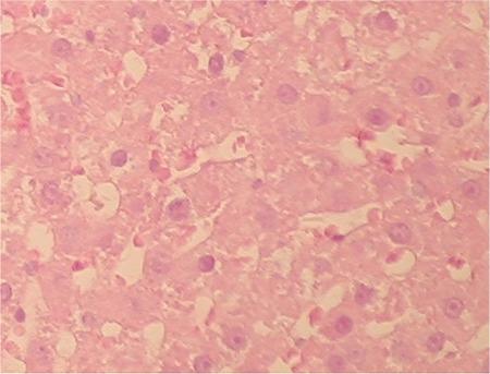 https://cdn.ncbi.nlm.nih.gov/pmc/blobs/4145/5863256/127e940e44f6/BMJ-35-174-g5.jpg