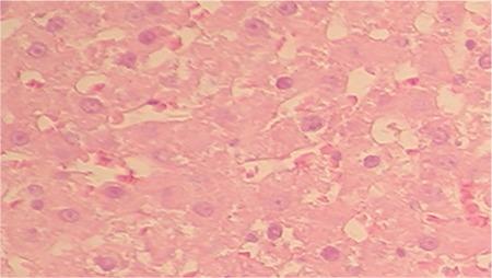 https://cdn.ncbi.nlm.nih.gov/pmc/blobs/4145/5863256/3a8190733d25/BMJ-35-174-g6.jpg