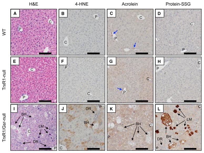 https://cdn.ncbi.nlm.nih.gov/pmc/blobs/4146/5730093/34419b33f273/nihms884918f3.jpg
