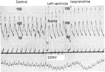 https://cdn.ncbi.nlm.nih.gov/pmc/blobs/414f/482007/84d0e47fc80d/brheartj00203-0026-b.jpg