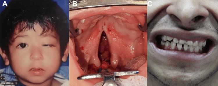 https://cdn.ncbi.nlm.nih.gov/pmc/blobs/4150/11786807/cceea44fcdc7/cureus-0017-00000076804-i01.jpg