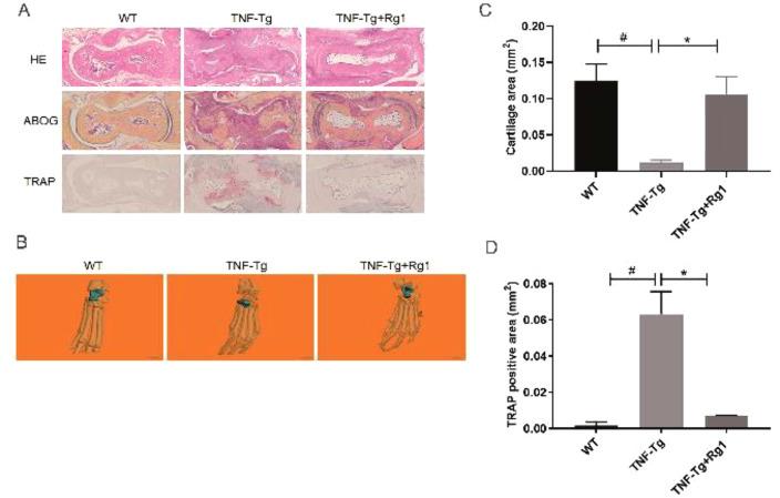 https://cdn.ncbi.nlm.nih.gov/pmc/blobs/4150/7716681/055f0d4cbbd8/JMNI-20-526-g004.jpg