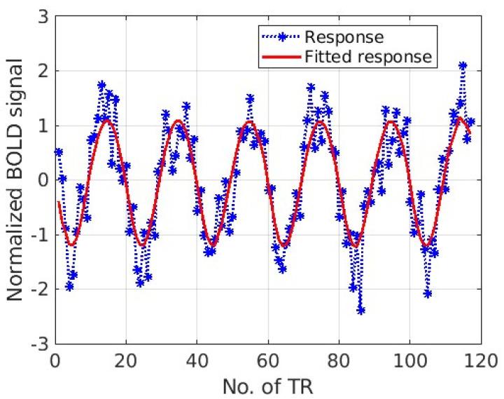 https://cdn.ncbi.nlm.nih.gov/pmc/blobs/4152/11511430/7371b31ee6da/tomography-10-00115-g005.jpg