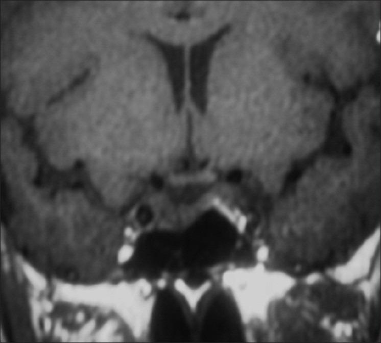 https://cdn.ncbi.nlm.nih.gov/pmc/blobs/4155/3475917/64cae0717ec8/IJEM-16-833-g001.jpg