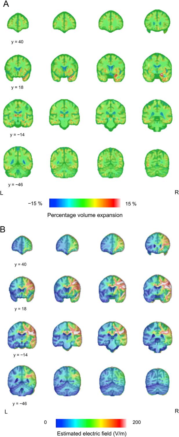 https://cdn.ncbi.nlm.nih.gov/pmc/blobs/415e/8474653/d76696a0cee7/nihms-1742053-f0004.jpg