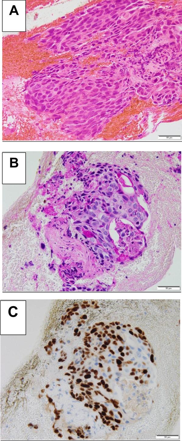 https://cdn.ncbi.nlm.nih.gov/pmc/blobs/4169/10984911/01a48c97d3d9/40792_2024_1868_Fig5_HTML.jpg