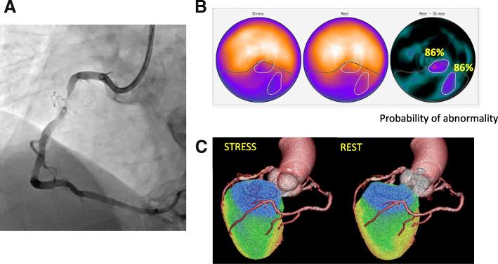 https://cdn.ncbi.nlm.nih.gov/pmc/blobs/4169/8212308/8b911fd72db7/41824_2019_52_Fig6_HTML.jpg
