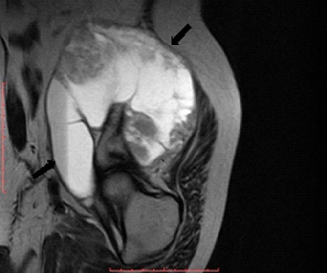 https://cdn.ncbi.nlm.nih.gov/pmc/blobs/4174/6159151/32f3ab6e3fe4/bjrcr.20170014.g007.jpg