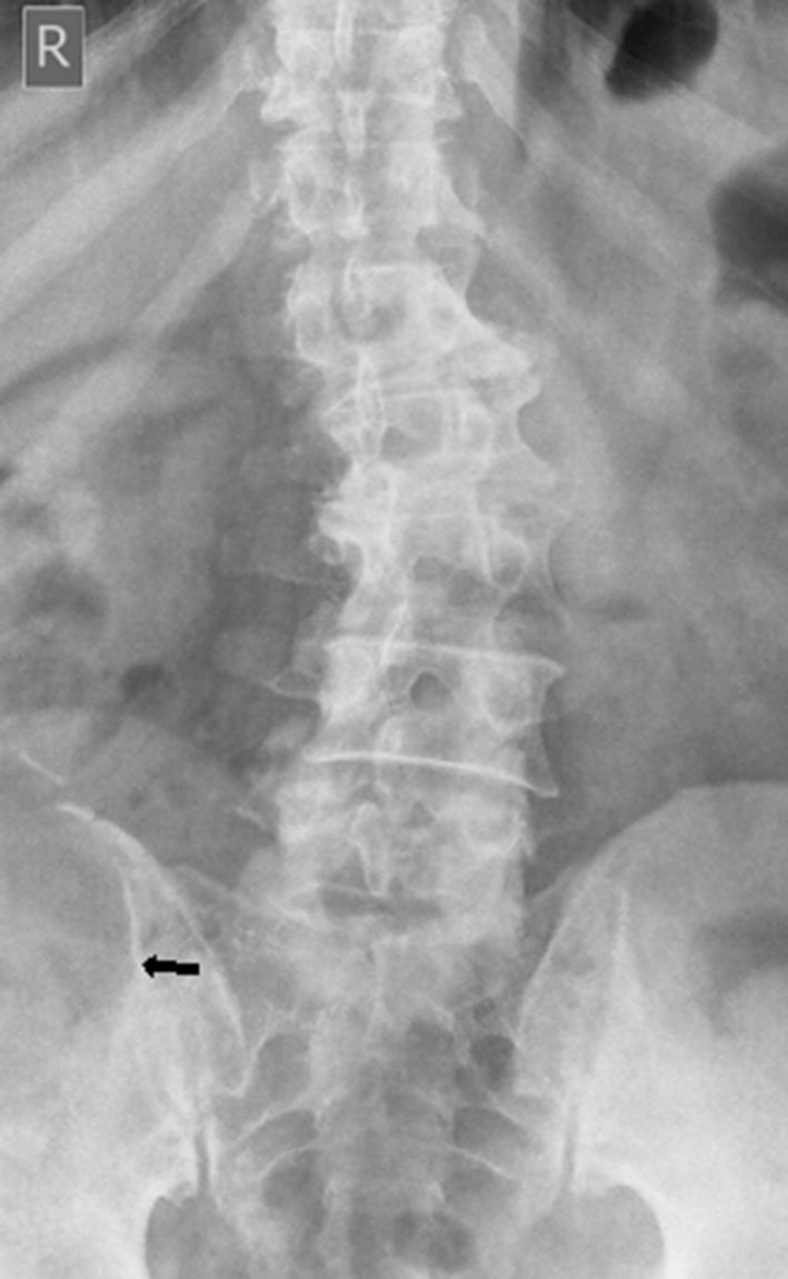 https://cdn.ncbi.nlm.nih.gov/pmc/blobs/4174/6159151/c78c3f22ad40/bjrcr.20170014.g001.jpg