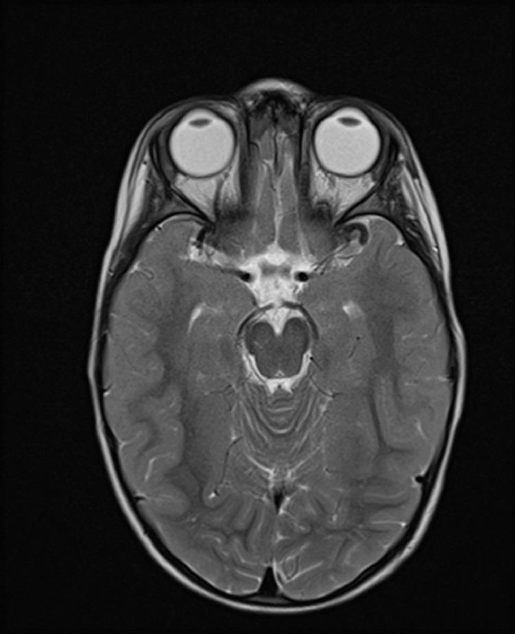 https://cdn.ncbi.nlm.nih.gov/pmc/blobs/4176/8326597/0d598ba605ab/gr4.jpg