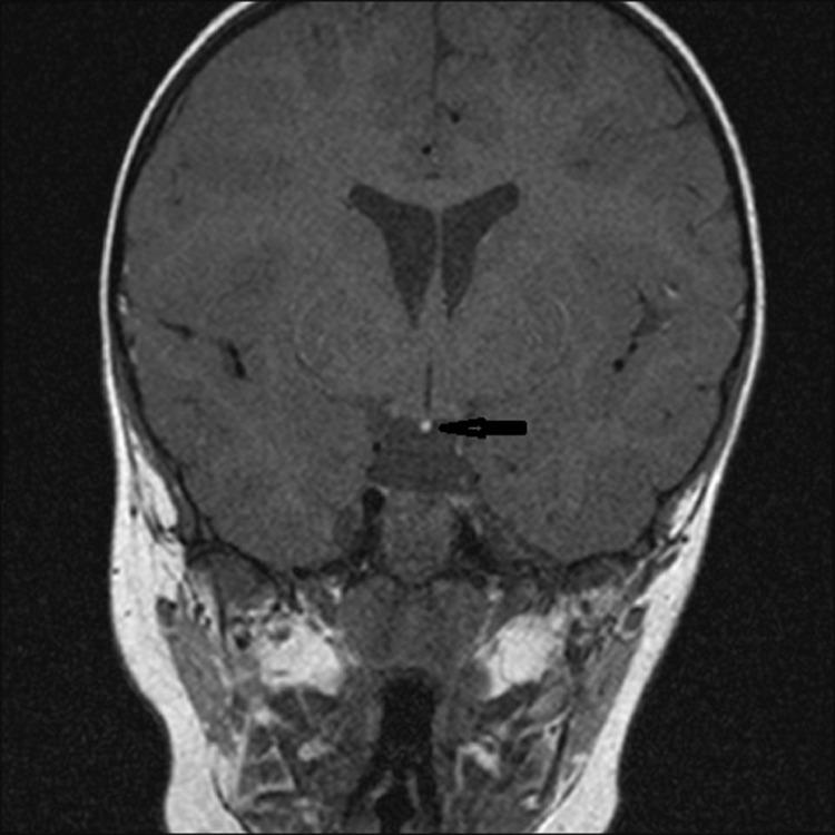 https://cdn.ncbi.nlm.nih.gov/pmc/blobs/4176/8326597/29ee736c6782/gr1.jpg