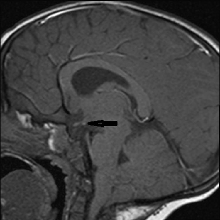 https://cdn.ncbi.nlm.nih.gov/pmc/blobs/4176/8326597/a6ac9ce2621c/gr2.jpg