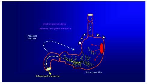https://cdn.ncbi.nlm.nih.gov/pmc/blobs/4177/5621105/0ef2ad4e3d9b/f1000research-6-13080-g0001.jpg