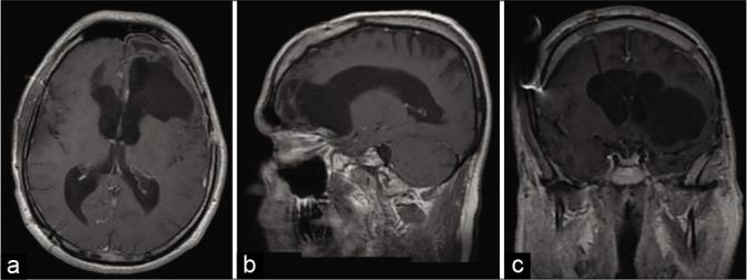 https://cdn.ncbi.nlm.nih.gov/pmc/blobs/417d/7982114/ab4b6a964478/SNI-12-88-g005.jpg