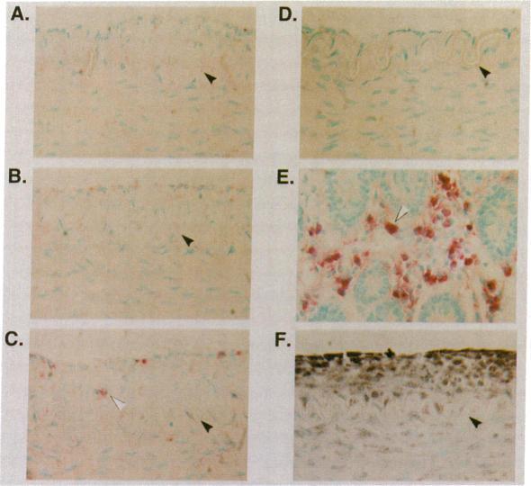 https://cdn.ncbi.nlm.nih.gov/pmc/blobs/4183/288164/84b9d1cec725/jcinvest00039-0571-a.jpg