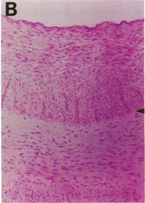 https://cdn.ncbi.nlm.nih.gov/pmc/blobs/4183/288164/a615a542c22b/jcinvest00039-0572-b.jpg