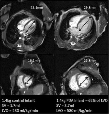 https://cdn.ncbi.nlm.nih.gov/pmc/blobs/4185/4145259/c72b76b11703/s12968-014-0054-4-1.jpg