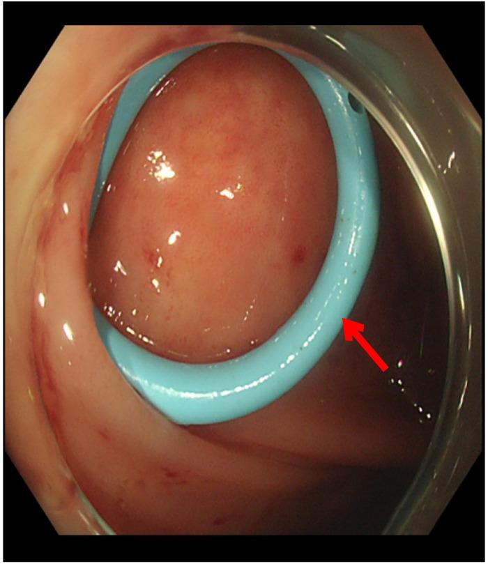https://cdn.ncbi.nlm.nih.gov/pmc/blobs/4189/9928201/02b55d48a1ab/fimmu-13-1020393-g006.jpg