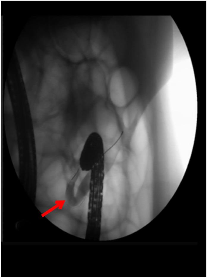 https://cdn.ncbi.nlm.nih.gov/pmc/blobs/4189/9928201/4e958e5ef9a5/fimmu-13-1020393-g005.jpg