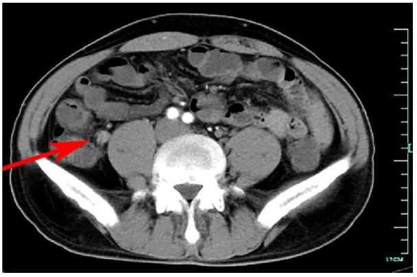 https://cdn.ncbi.nlm.nih.gov/pmc/blobs/4189/9928201/8a04dcf319c1/fimmu-13-1020393-g001.jpg