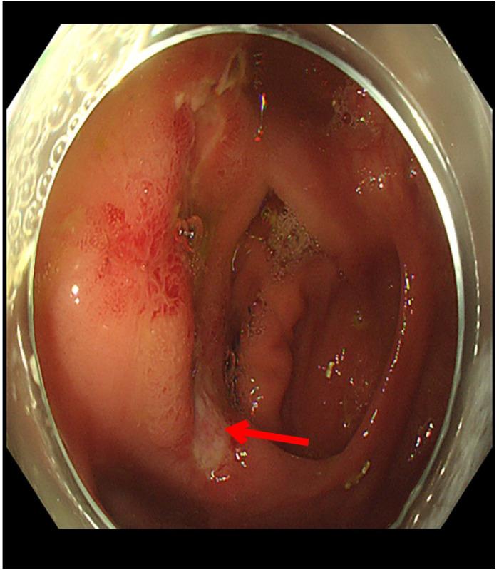 https://cdn.ncbi.nlm.nih.gov/pmc/blobs/4189/9928201/de63aaf9d65d/fimmu-13-1020393-g002.jpg