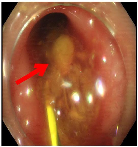 https://cdn.ncbi.nlm.nih.gov/pmc/blobs/4189/9928201/f85f0b5673f2/fimmu-13-1020393-g004.jpg