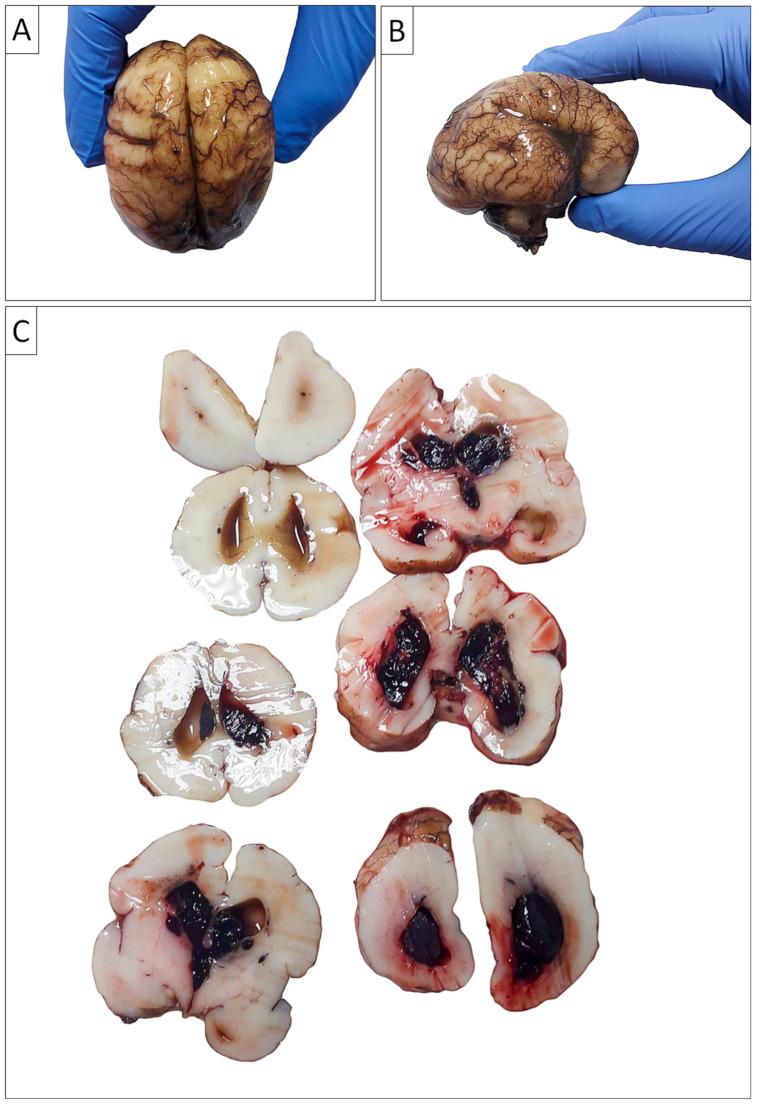 https://cdn.ncbi.nlm.nih.gov/pmc/blobs/418a/11762540/9d7e69e41d77/biomedicines-13-00196-g004.jpg