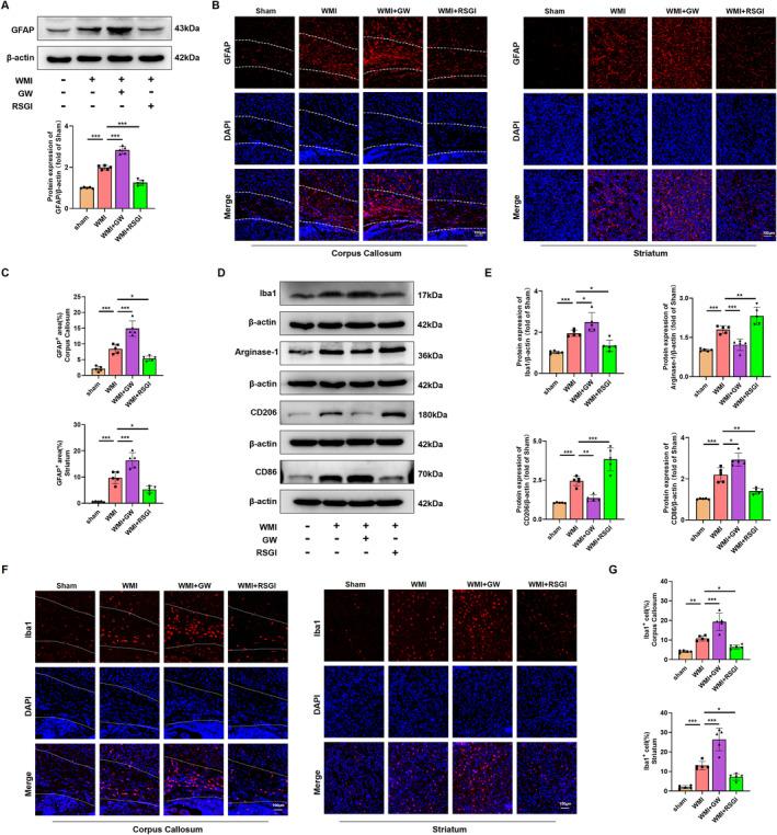 https://cdn.ncbi.nlm.nih.gov/pmc/blobs/4193/11534457/1cbc91f7bf60/CNS-30-e70081-g003.jpg