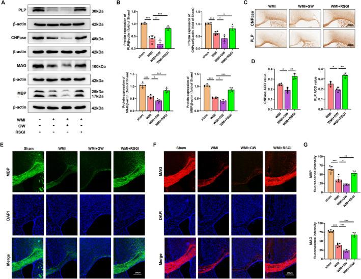 https://cdn.ncbi.nlm.nih.gov/pmc/blobs/4193/11534457/e000e5360cee/CNS-30-e70081-g009.jpg