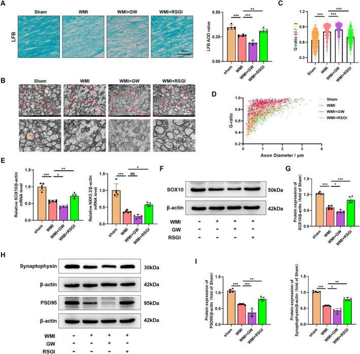 https://cdn.ncbi.nlm.nih.gov/pmc/blobs/4193/11534457/f2a88cba8b9a/CNS-30-e70081-g005.jpg