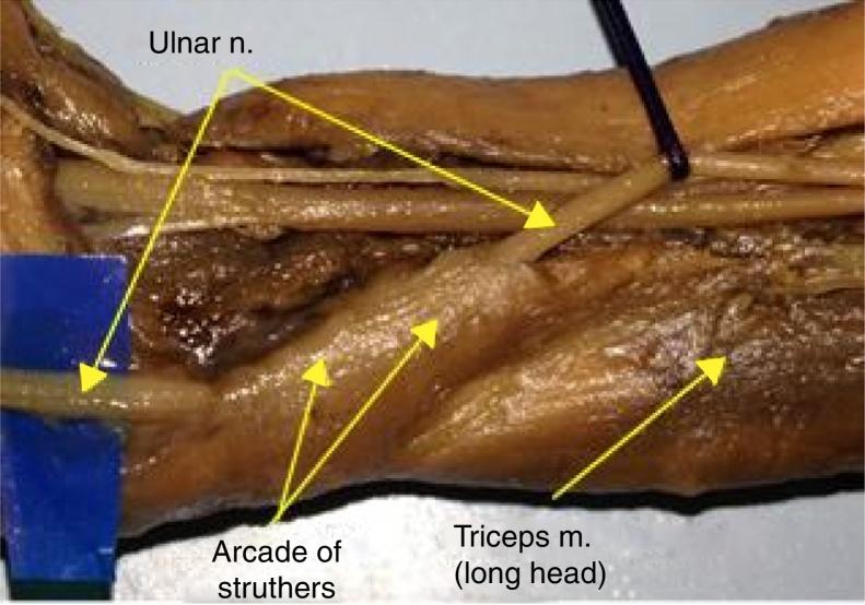 https://cdn.ncbi.nlm.nih.gov/pmc/blobs/4193/5497011/304c6ce1d51f/gr2.jpg