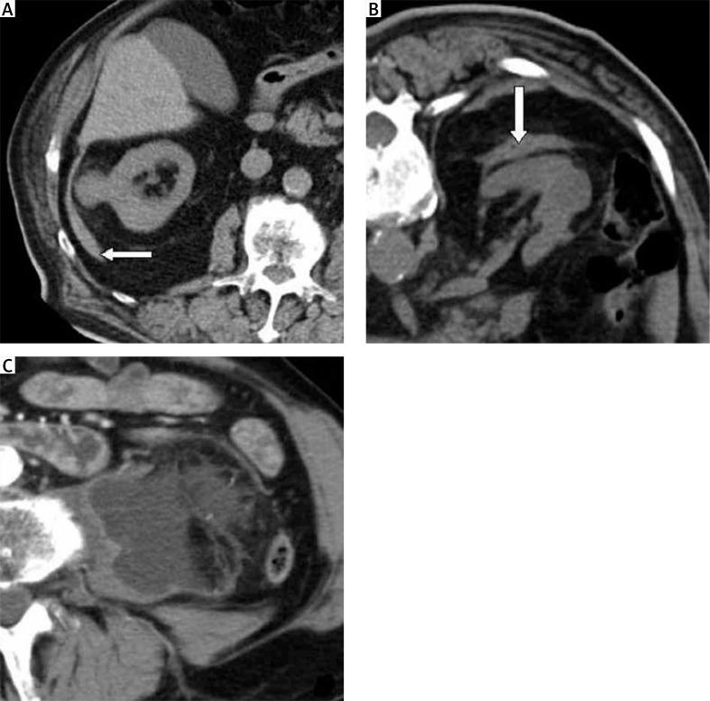 https://cdn.ncbi.nlm.nih.gov/pmc/blobs/41a4/5776489/cd4fccaafd3e/WIITM-12-31330-g004.jpg
